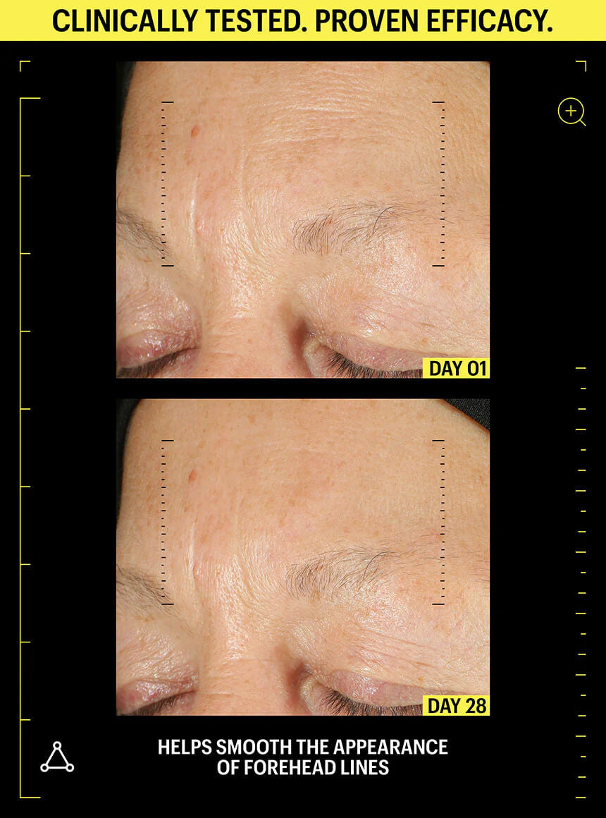 Allies of Skin Retinal 0.05% & Peptides Repair Night Cream 1.6 fl oz - SkinElite - before & after 1