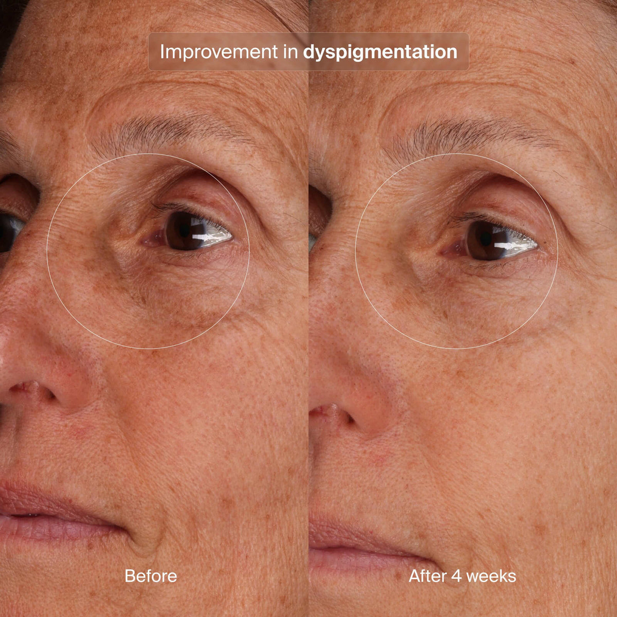 Pavise Bioadaptive Stress Repair 1 fl oz - SkinElite - Before and After 6