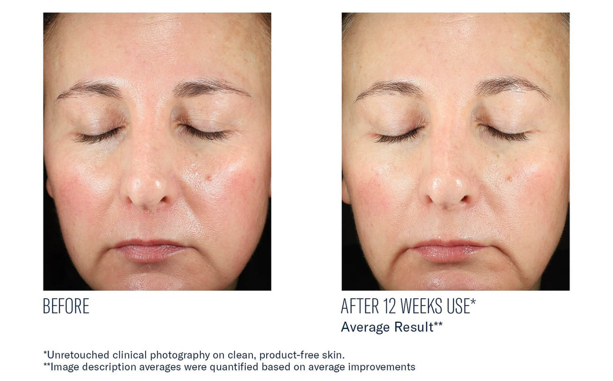 SkinBetter Science BioRewind Skin Health Dietary Supplement - 60 caps - SkinElite - before and after 2