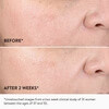 goop beauty GoopGlow 15% Glycolic Acid Overnight Glow Peel - 4 peels - Skin Elite - before and after