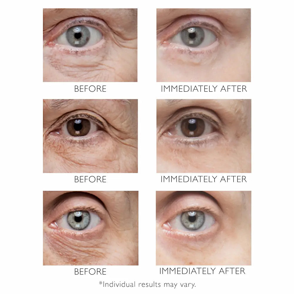 Peter Thomas Roth Instant Firmx Eye Temporary Eye Tightener 1 fl oz- Before and after
