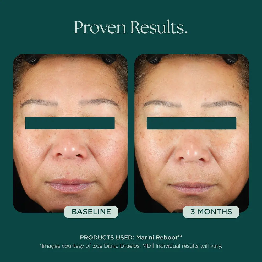 Marini SkinSolutions Marini Reboot® PDRN Face Serum 1 oz before and after 2