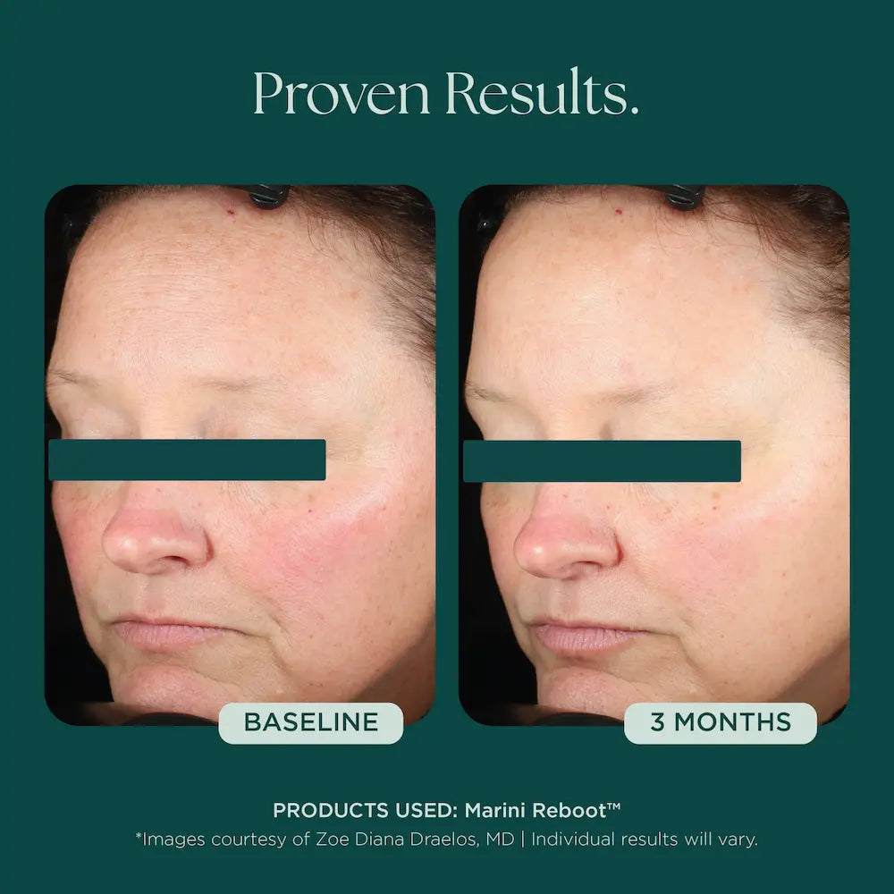 Marini SkinSolutions Marini Reboot® PDRN Face Serum 1 oz before and after 3