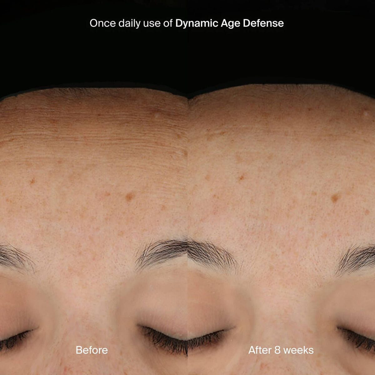 Pavise Dynamic Age Defense 1 oz - SkinElite - before and after 2