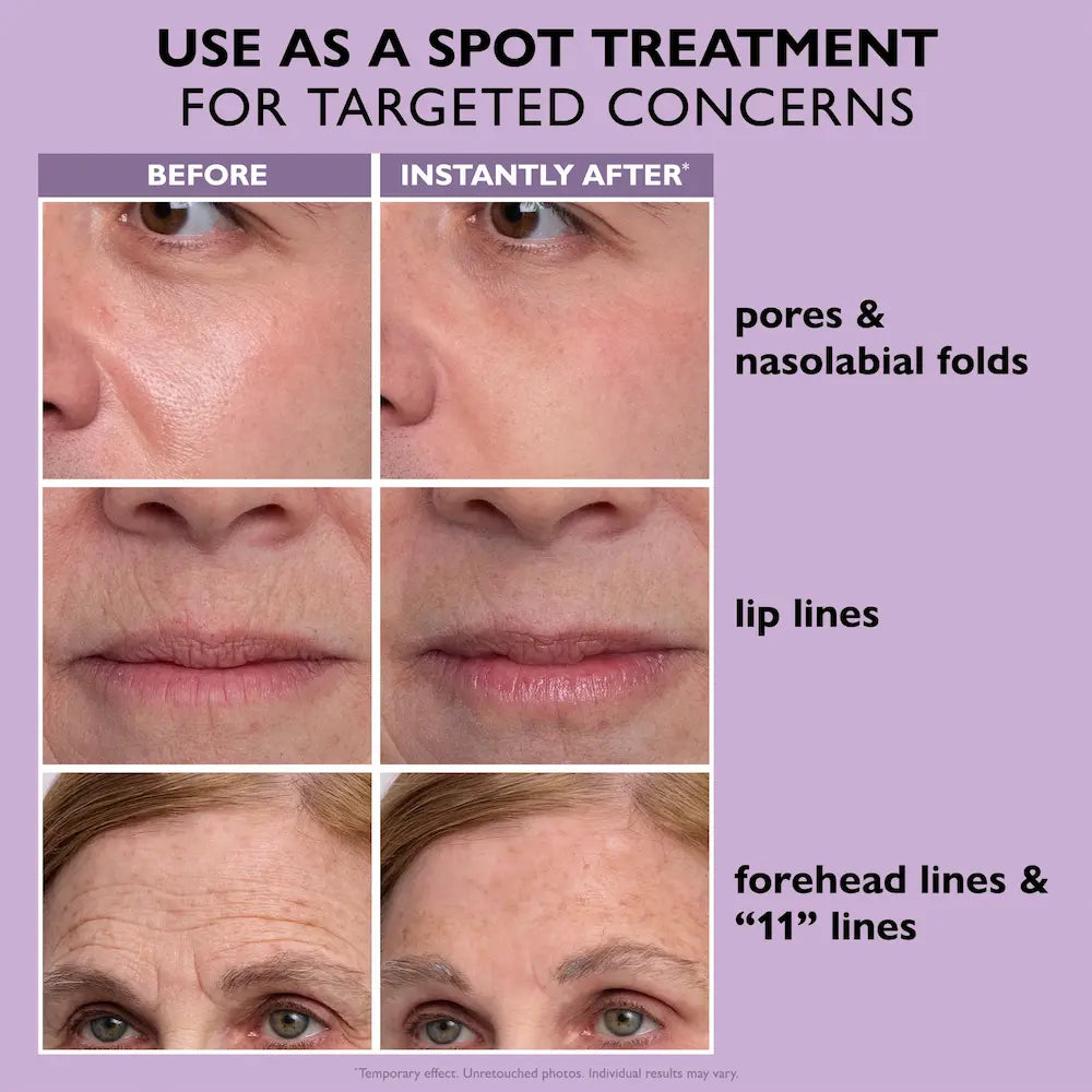 Peter Thomas Roth Instant FIRMx® Temporary Face Tightener Easy-Wear Formula 1.35 oz before and after 2