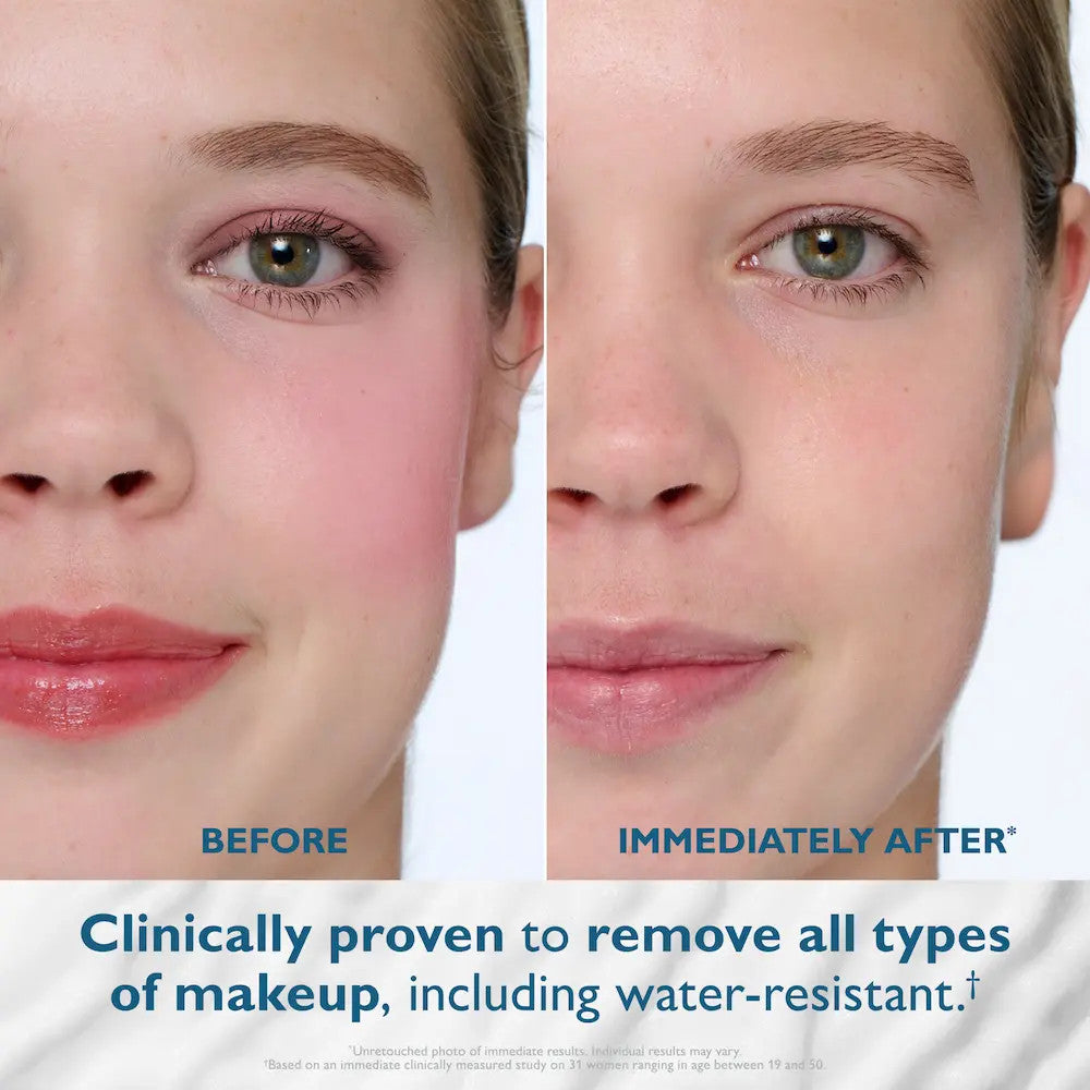Peter Thomas Roth Water Drench Ice Facial Cooling Mist -before and after