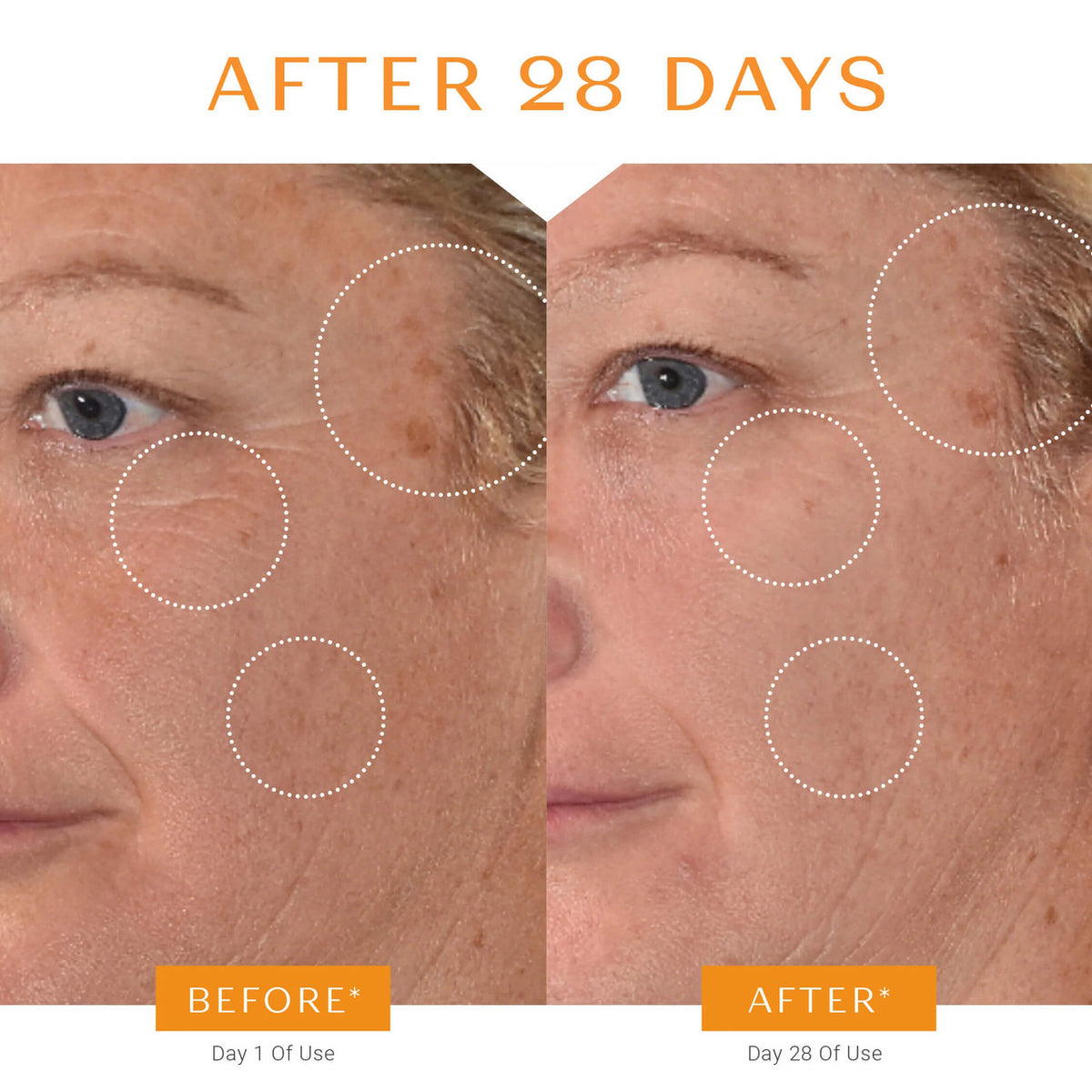 Yon-Ka Paris Serum Vitamine C - Skin Elite - before and after 3