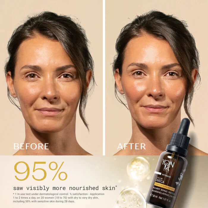 Yon-Ka Paris Serum Omega - Skin Elite - before and after