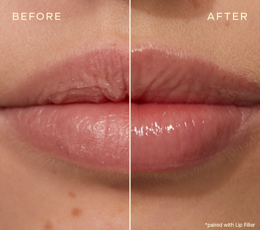 Ourself Mini Lip Conditioner with Vitamin E 0.10 fl oz - SkinElite - before and after 2