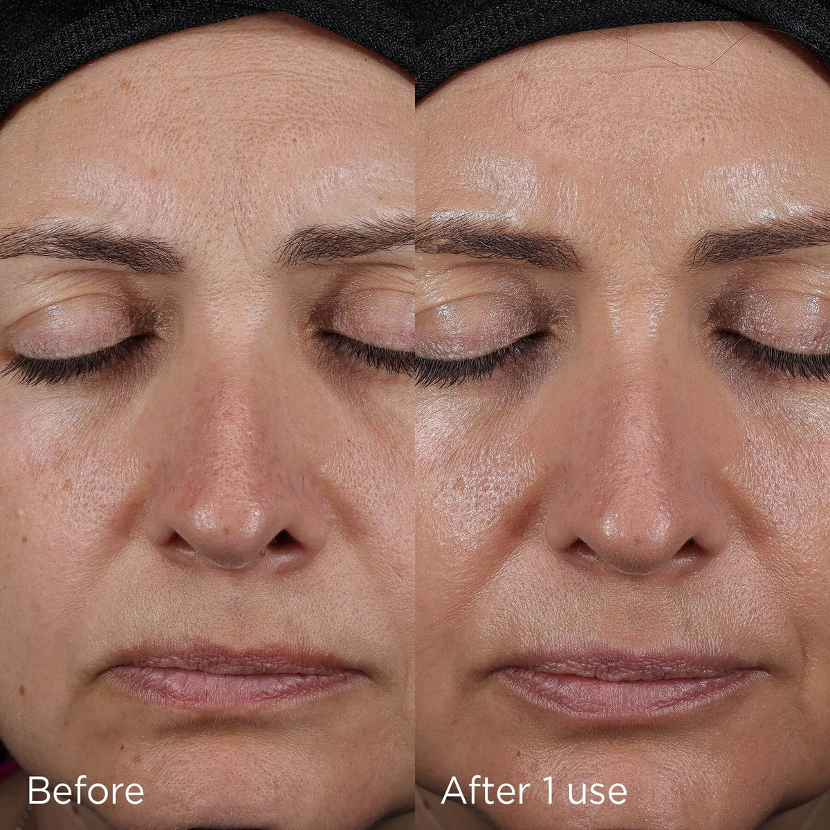 IMAGE DAILY PREVENTION advanced smartblend mineral moisturizer SPF 75 - 1.7 fl oz - SkinElite - before and after