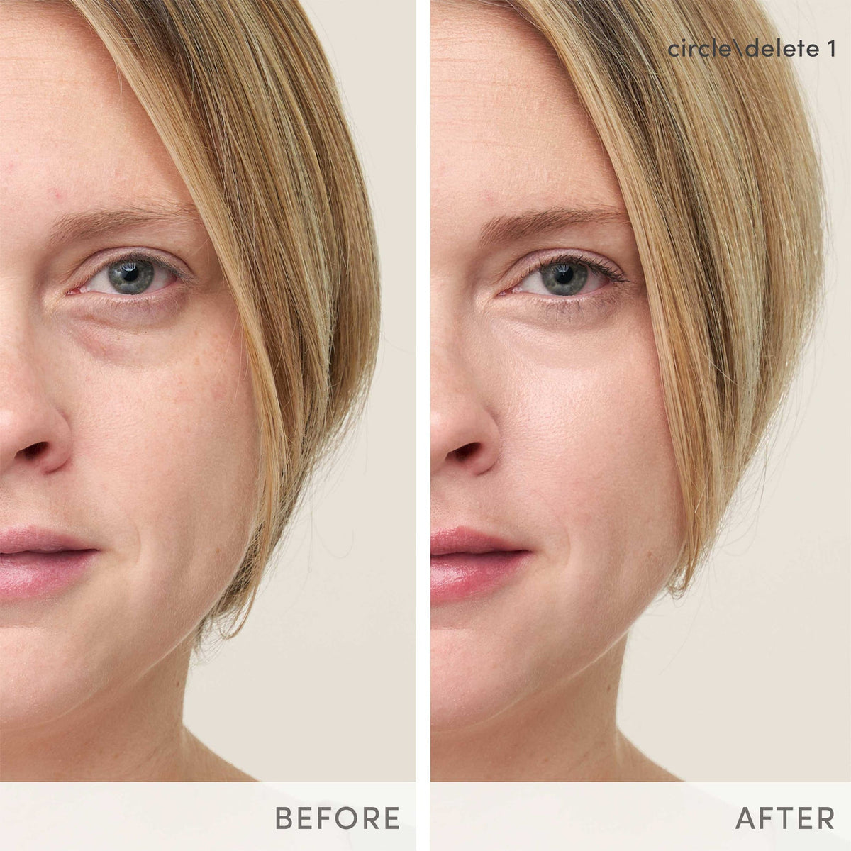 Jane Iredale Circle\Delete® Concealer - SkinElite - before and after