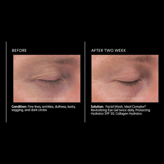 PCA Skin Ideal Complex Eye Cream 0.5 fl oz - results