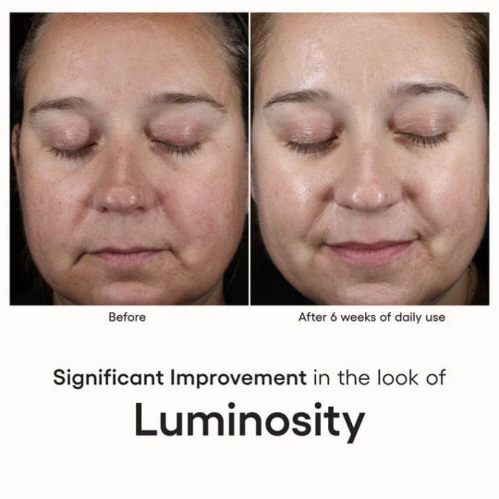 ( plated ) Skin Science INTENSE Serum before and after - SkinElite