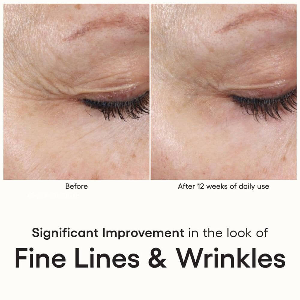 ( plated ) Skin Science INTENSE Serum Duo fine lines and wrinkles - SkinElite