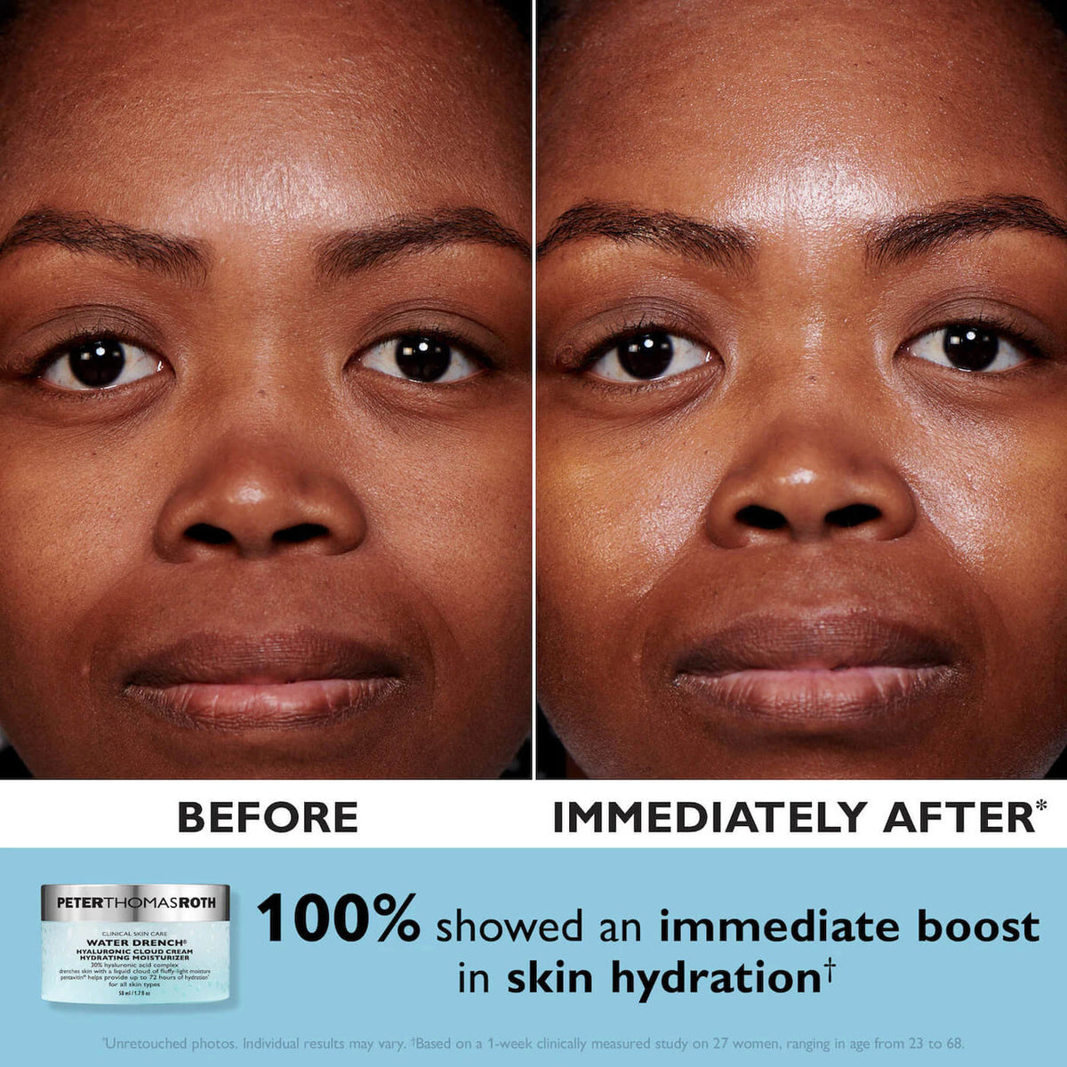 Peter Thomas Roth Full-Size Day & Night Cloud Creams 2-Piece Kit - Skin Elite - Cloud Cream Clinical Results